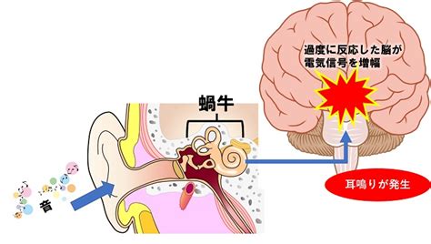 耳鳴 時間|耳鳴りとは？発生する仕組みと原因、適切に治療・対。